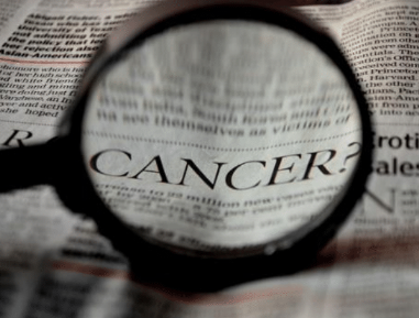 Oral Cancer Screening Can Save Your Life | Best Lake Jackson Dentist